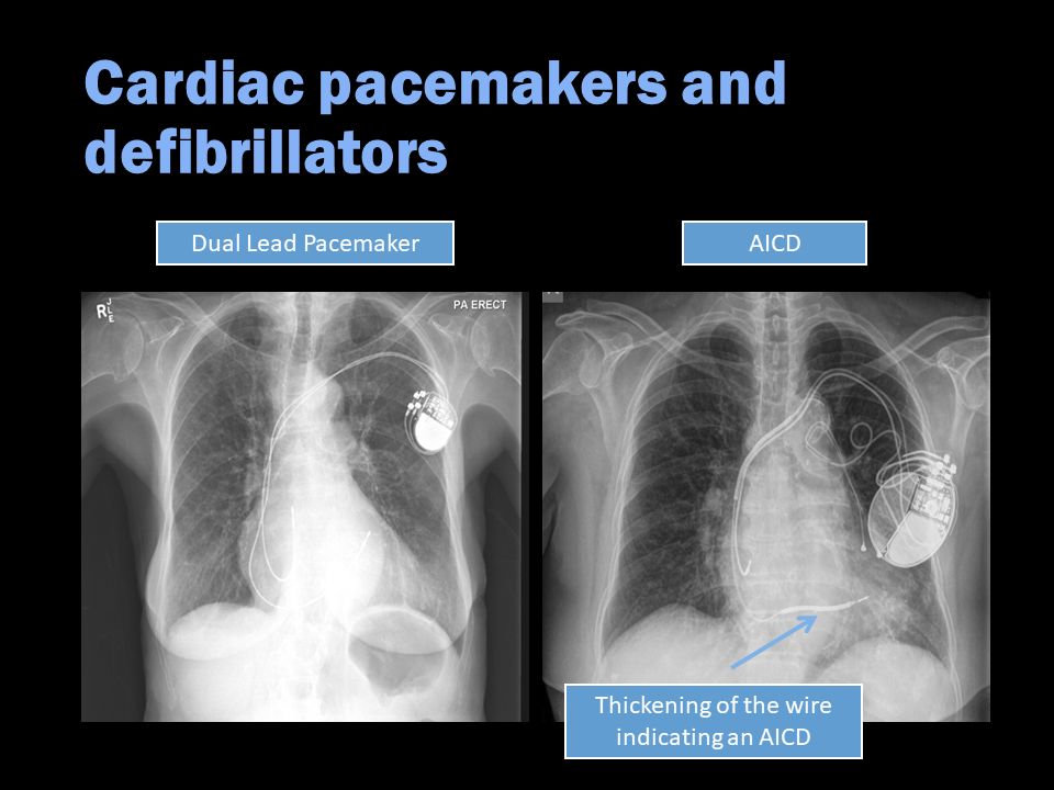 Radiology Quiz 137527 Radiopaedia Org Playlist Intern Education