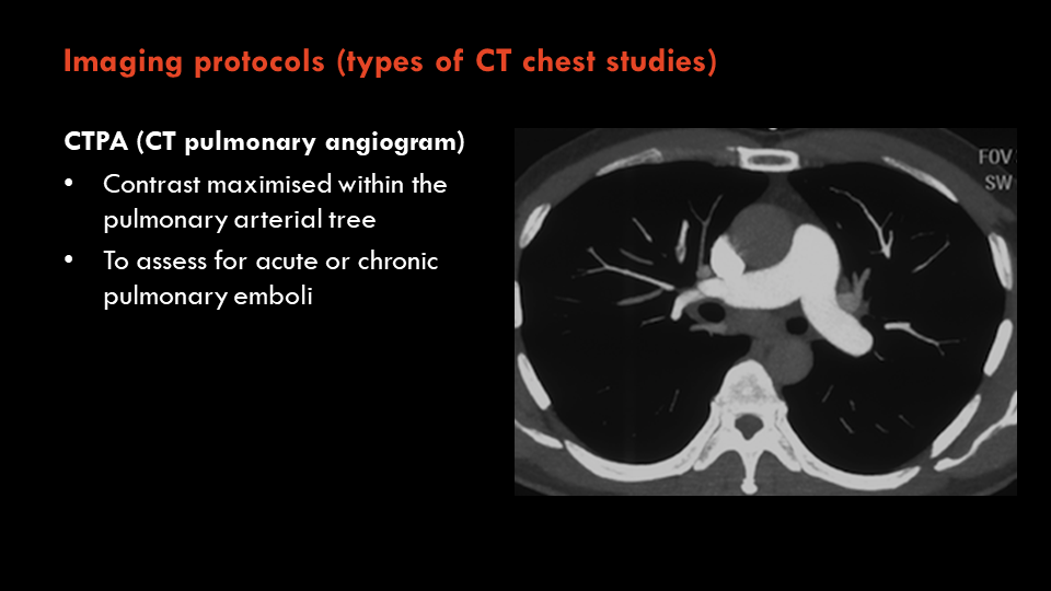 Radiology Quiz Radiopaedia Org Playlist Year