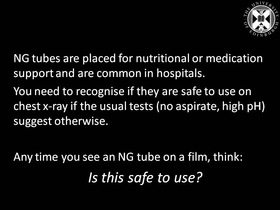 Radiology Quiz Radiopaedia Org Playlist Nasogastric Tube