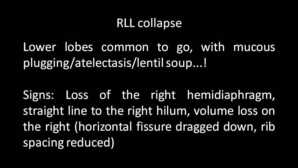 Radiology Quiz Radiopaedia Orgviewing Playlist Cxr Reviews