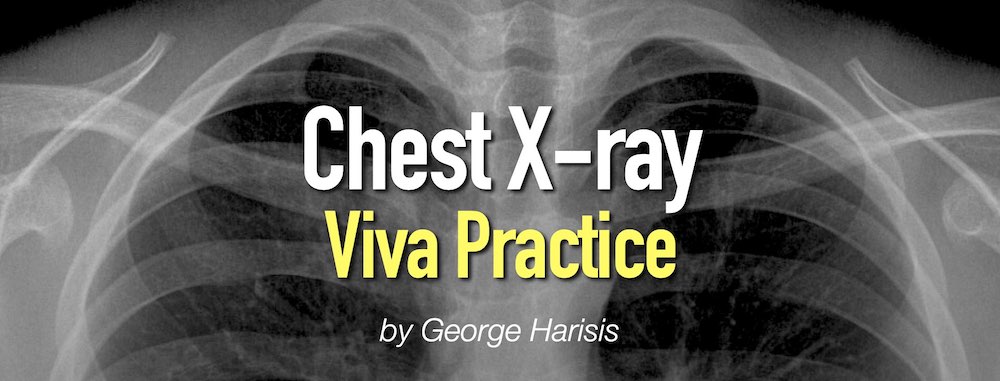 Viva Practice Chest X Ray Radiopaedia Org