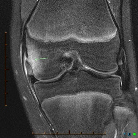 Playlist 'knee Mr' By Dr Matt A. Morgan