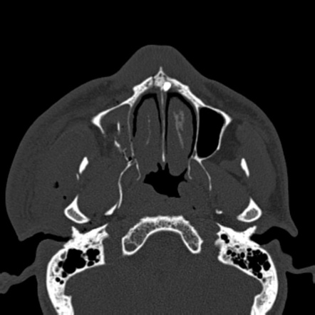 Image | Radiopaedia.org