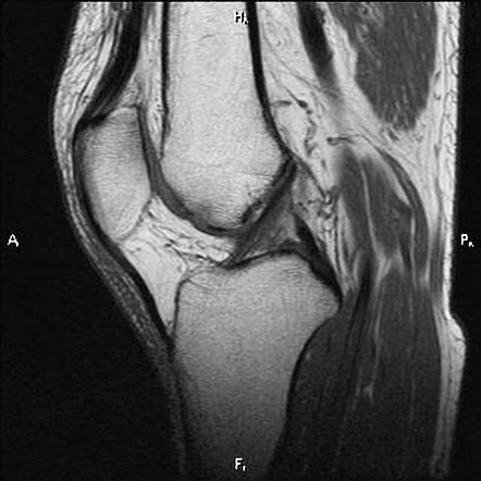 Viewing playlist: JOELHO | Radiopaedia.org