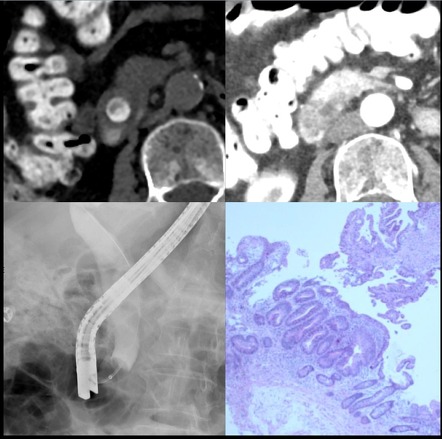 Viewing playlist: ERCP | Radiopaedia.org