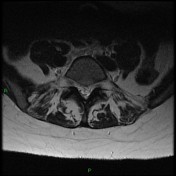 Viewing playlist: Spine | Radiopaedia.org