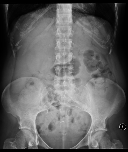 Abnormal abdominal shape.  Download Scientific Diagram