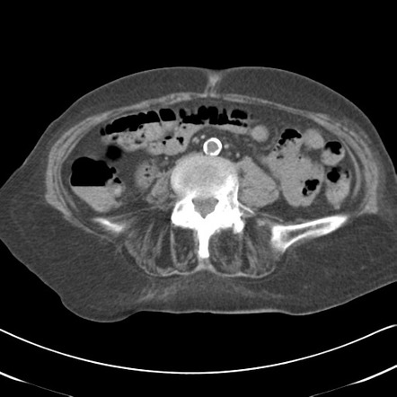 Radiology Quiz 34216 | Radiopaedia.org