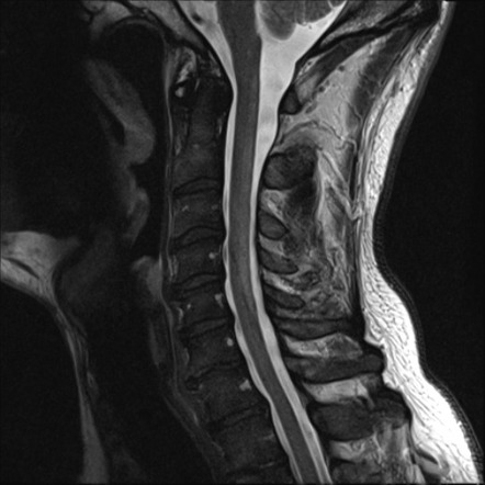 Viewing playlist: VGHTC 201504 | Radiopaedia.org