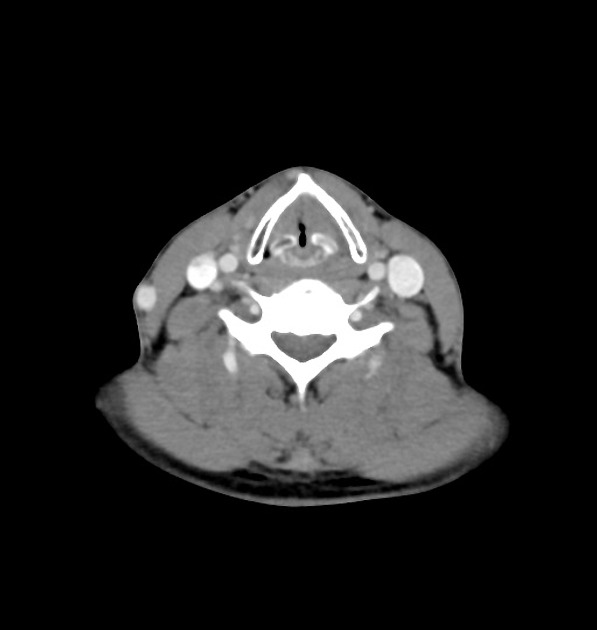 Radiology Quiz 34689 | Radiopaedia.org