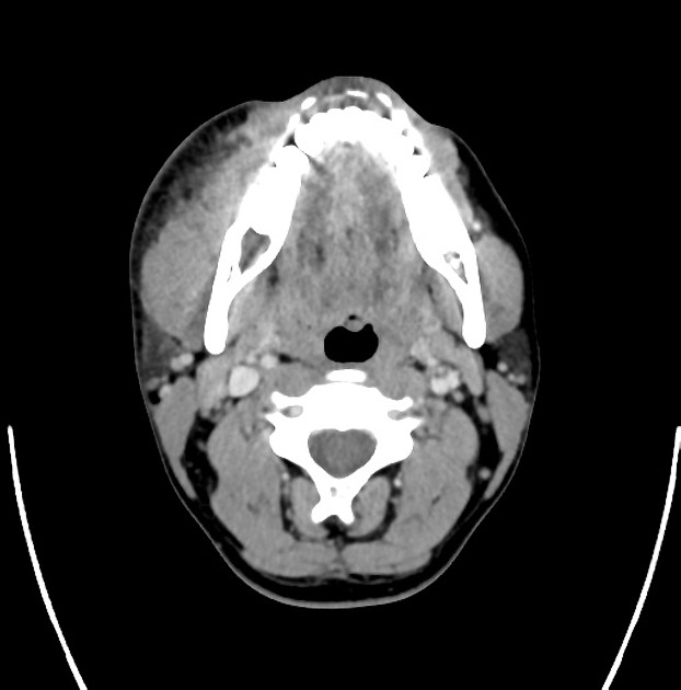 Radiology Quiz 34698 | Radiopaedia.org