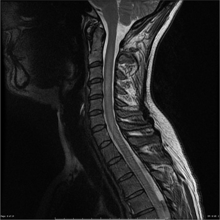 Playlist 'NMO' by Dr Ruben Alvaro Antezana Muñoz