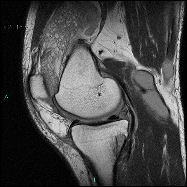 Radiology Quiz 34709 | Radiopaedia.org