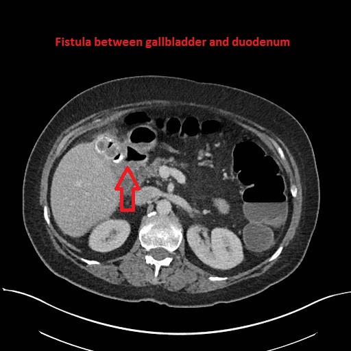 Image | Radiopaedia.org