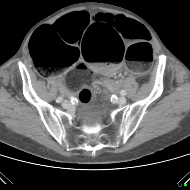 Radiology Quiz 34846 | Radiopaedia.org