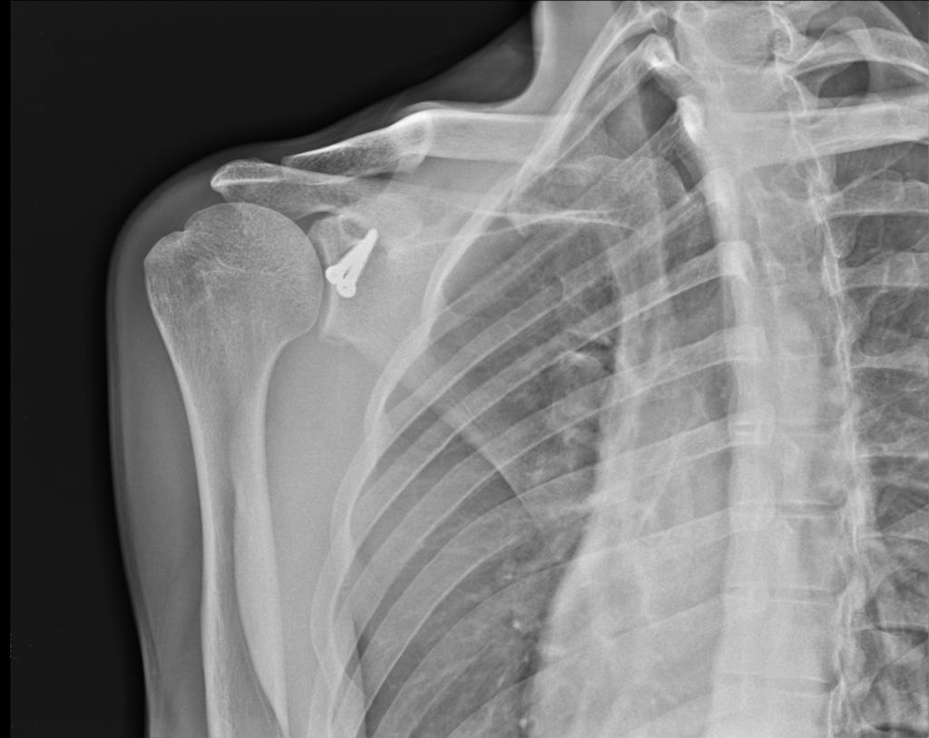 Radiology Quiz 14199 | Radiopaedia.org