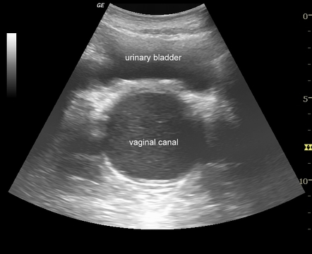 Viewing Playlist Pelvis General Radiopaedia Org