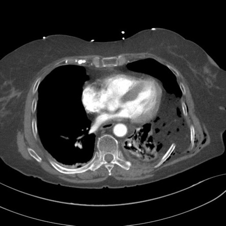 Radiology Quiz 35173 | Radiopaedia.org