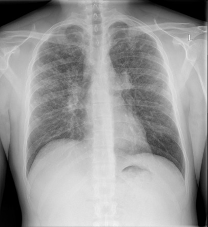 Hidden Diagnosis Case | Radiology Case | Radiopaedia.org