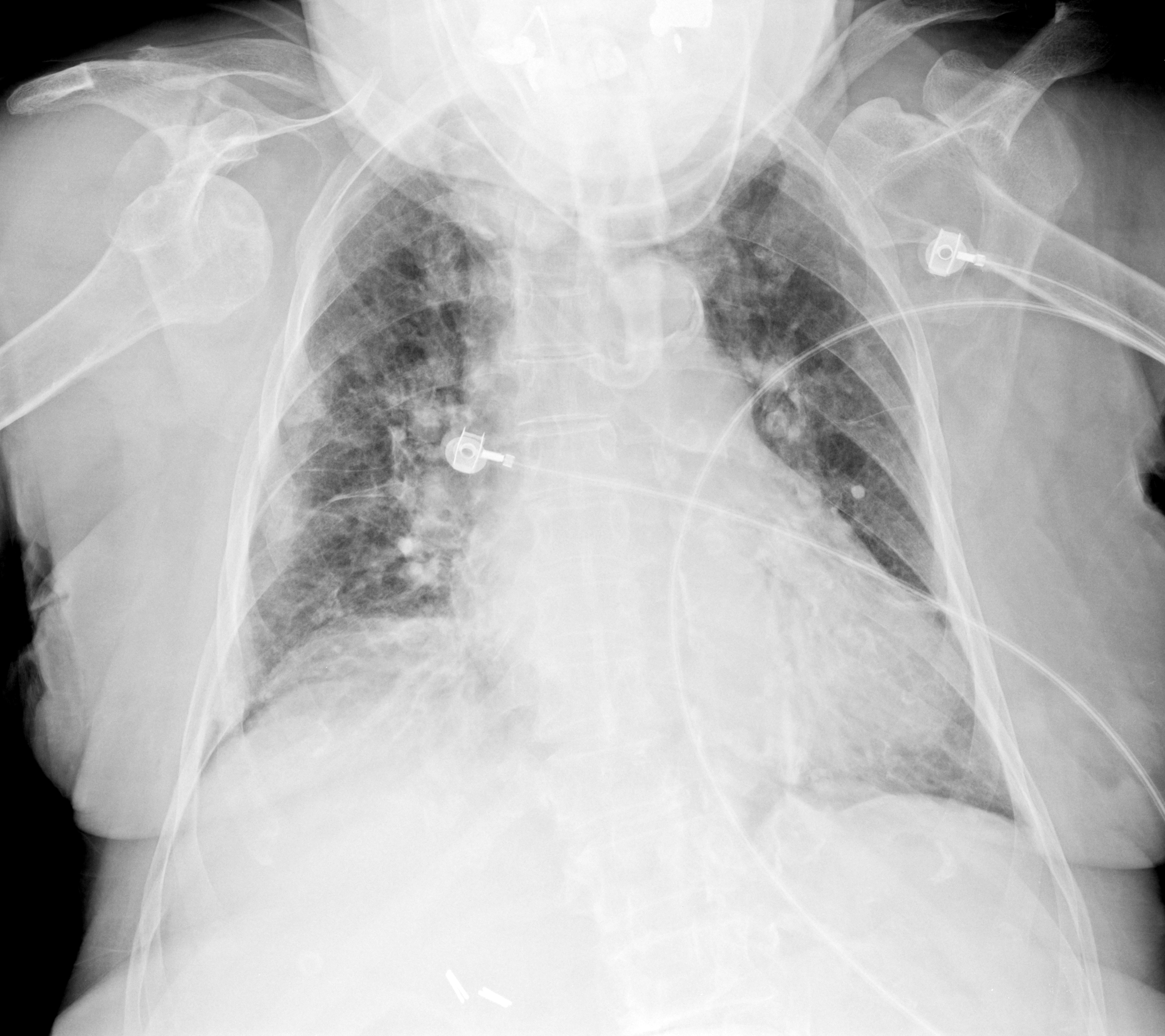 Chest Radiograph Wikidata