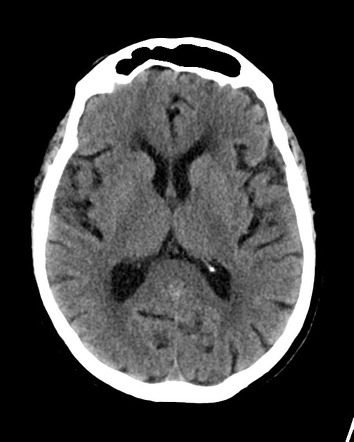 Viewing playlist: VGHTC 201506 | Radiopaedia.org