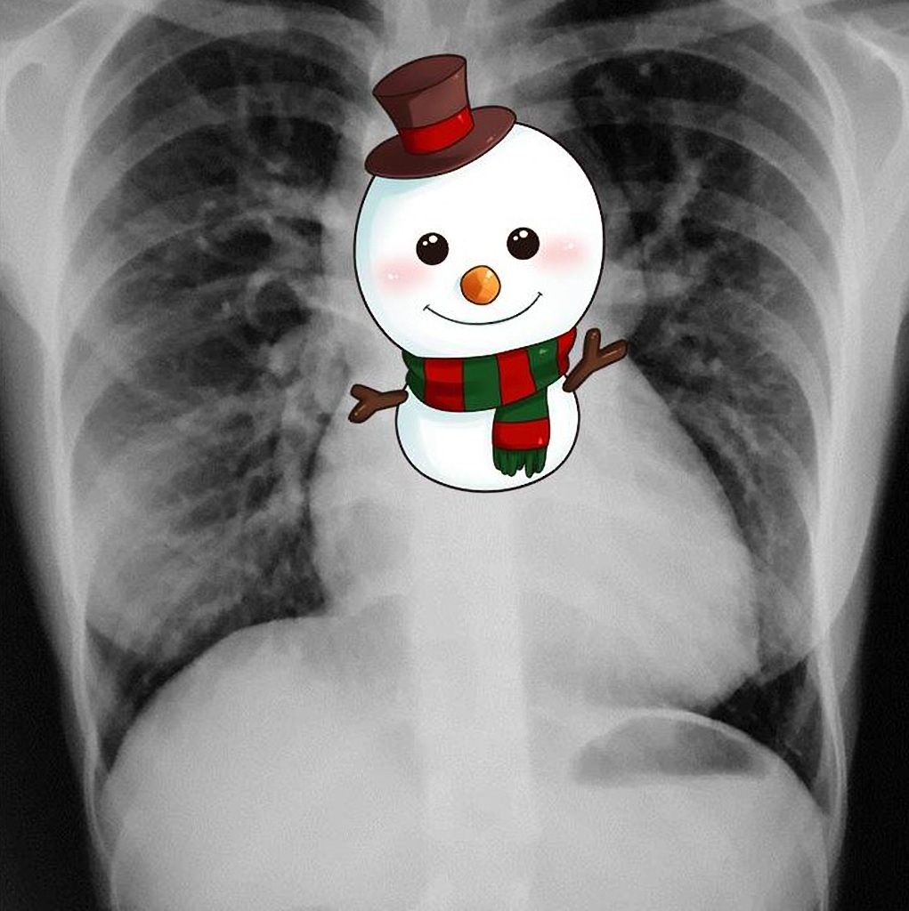 Radiology Quiz 36858 | Radiopaedia.org