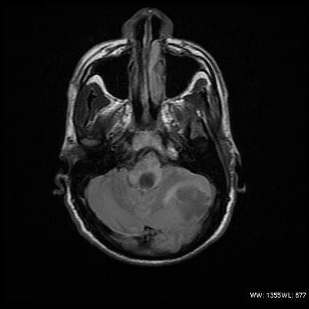 Viewing playlist: MRT Hirn | Radiopaedia.org