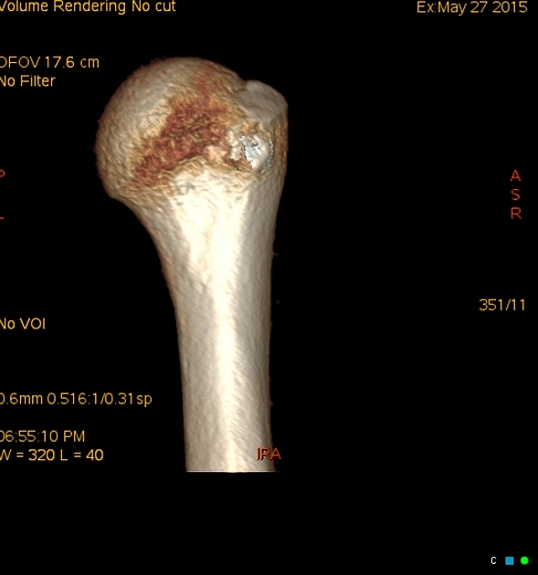 Radiology Quiz Radiopaedia Org