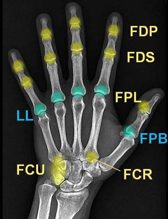 Hands, Radiology Reference Article