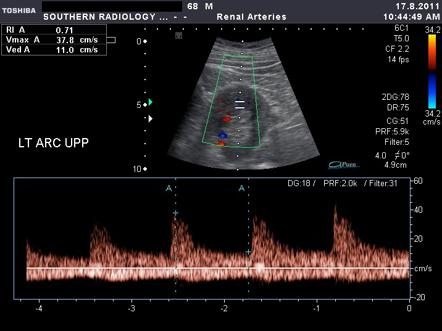 Image | Radiopaedia.org