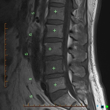 Image | Radiopaedia.org