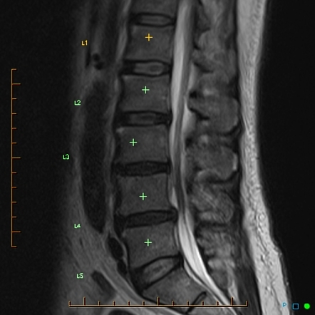 Image | Radiopaedia.org