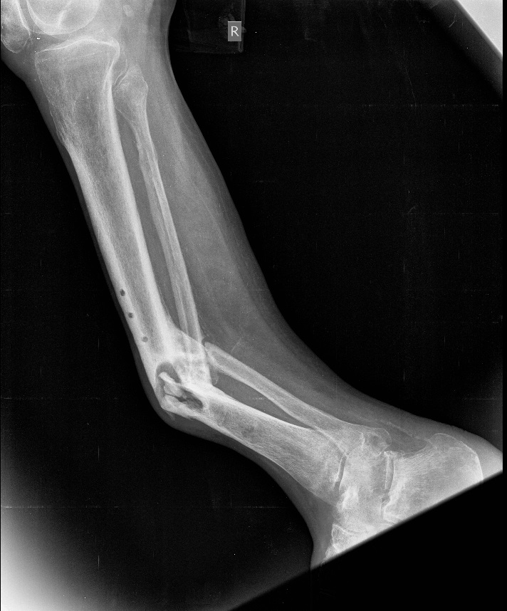 Jun on X: IMO, the Z-shaped orientaion of femur-tibia 2 is unusual for a  pygnogonid unless they're coxae-tibiae. There's also a short section  (arrowhead) between femur and tibia 1 which looks like