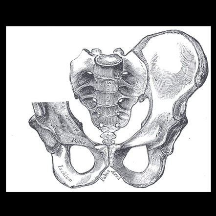 Type 1 pelvic resection | Radiology Reference Article | Radiopaedia.org