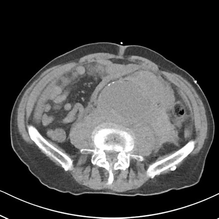 Viewing playlist: EXAM | Radiopaedia.org