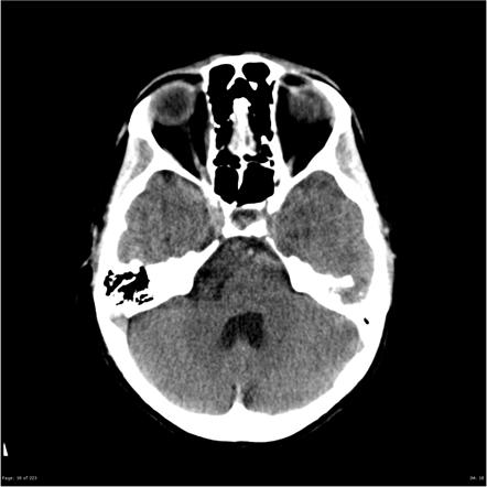 Image | Radiopaedia.org