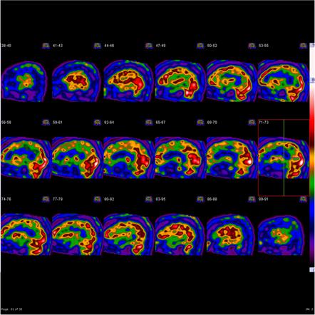 Image | Radiopaedia.org