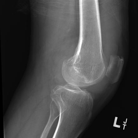 Playlist 'Benign synovial mass lesions. Part 1 - non-iflammatory' by Dr ...