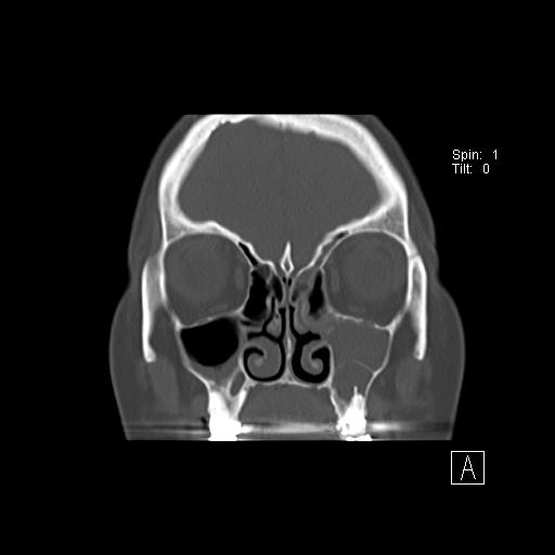 Image | Radiopaedia.org