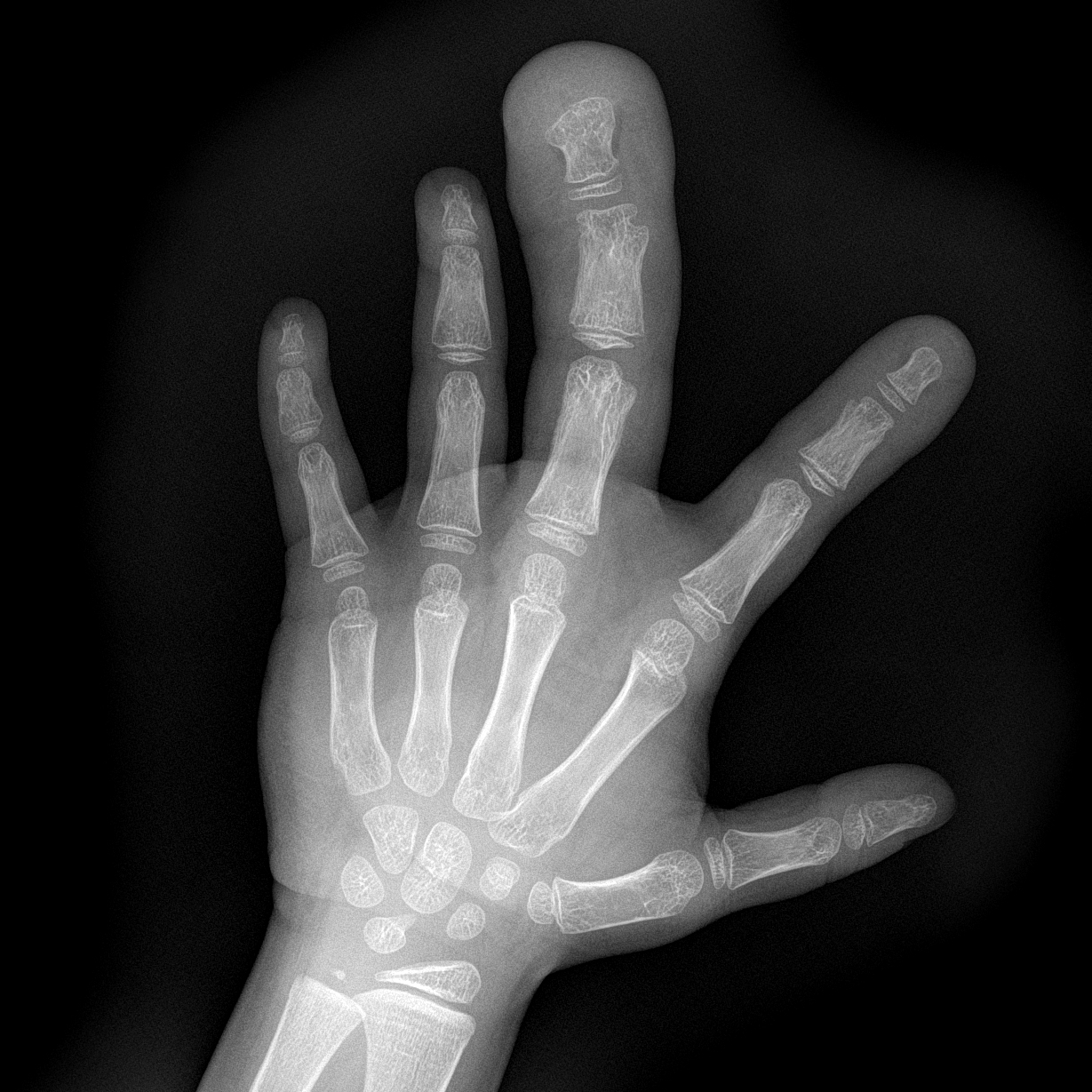 X Ray Hand Drawing