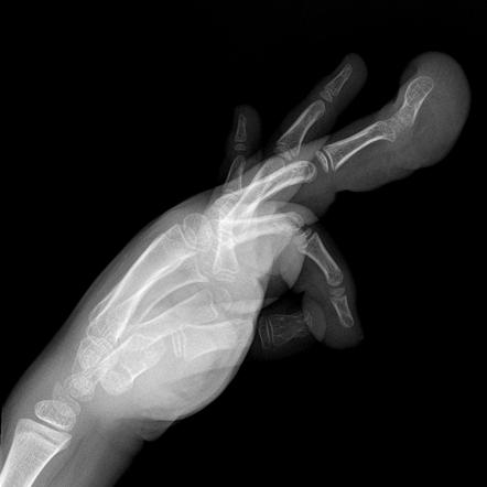 X Ray Hand Drawing