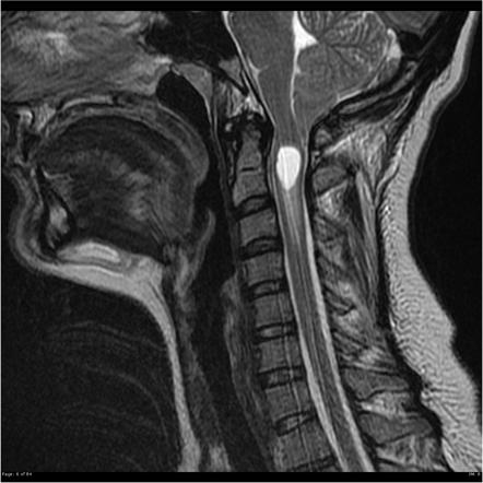 Viewing playlist: Head and neck | Radiopaedia.org