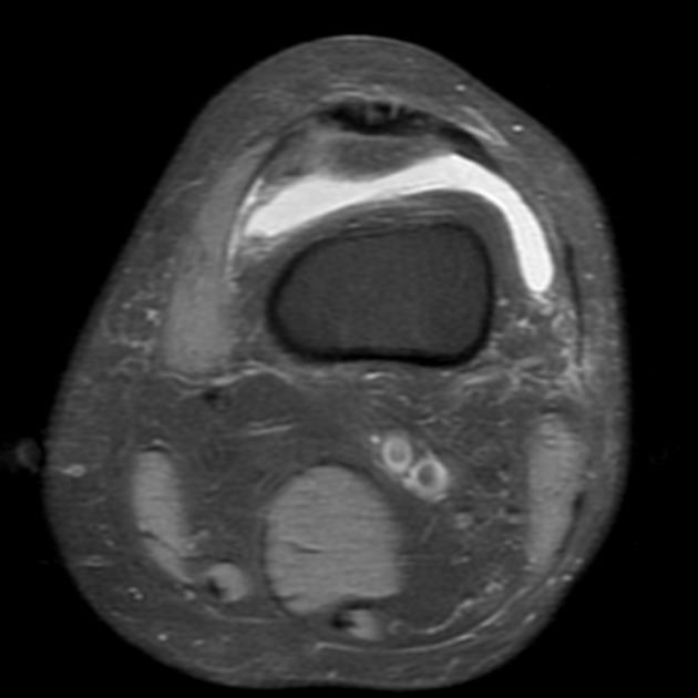 Radiology Quiz 15932 | Radiopaedia.org