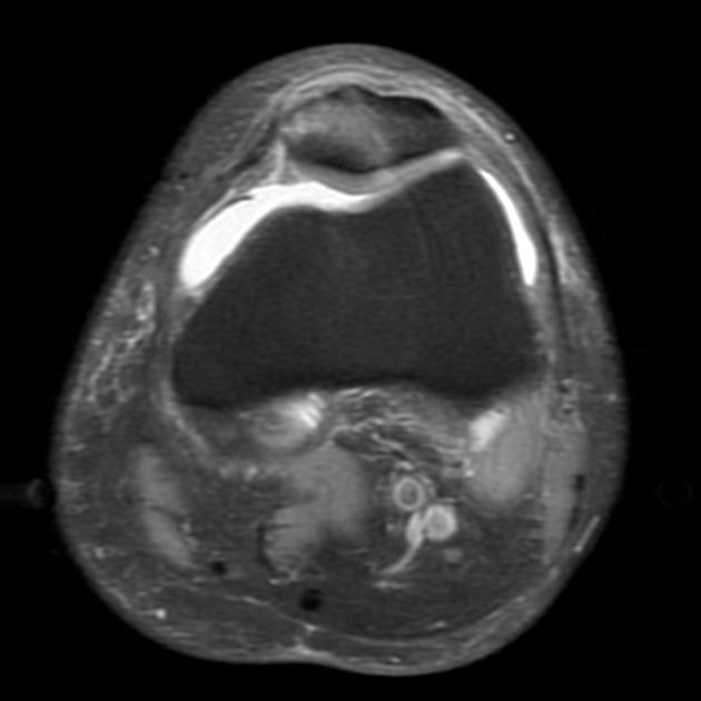 Radiology Quiz 15932 | Radiopaedia.org