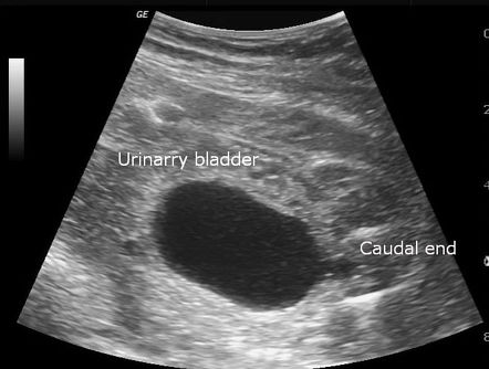 Keyhole sign (posterior urethral valves) | Radiology Reference Article ...