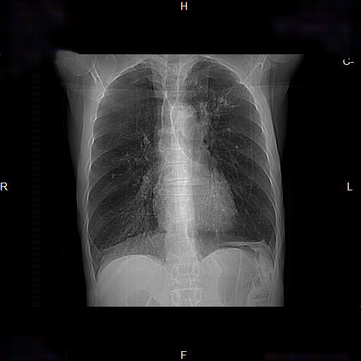 image-radiopaedia