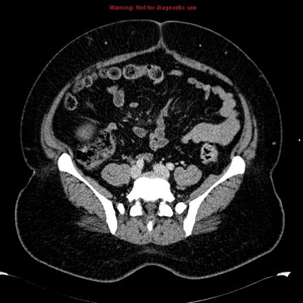 Image | Radiopaedia.org