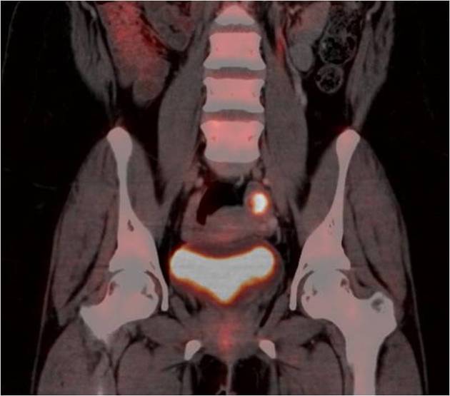 Corpus luteum, Radiology Reference Article