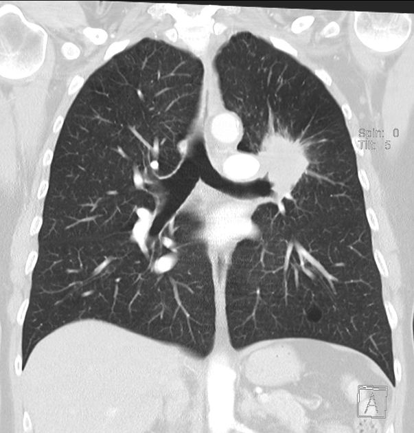 Radiology Quiz 39727 | Radiopaedia.org