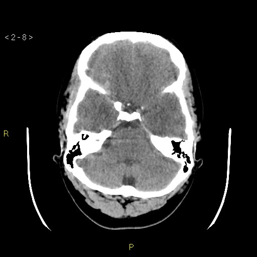 Image | Radiopaedia.org